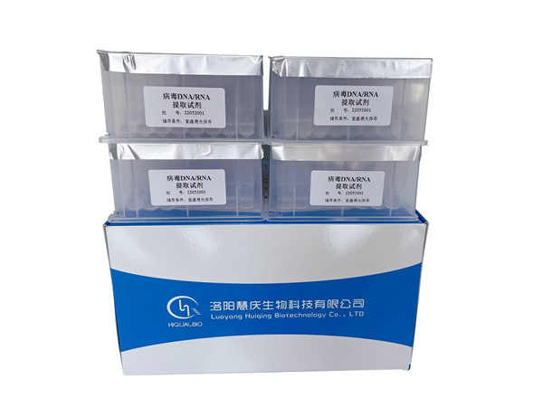 磁珠法核酸提取試劑盒的選購要求有哪些？